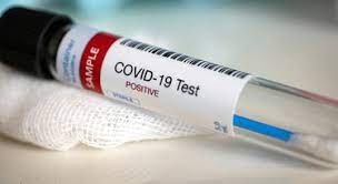 Алгоритм дій у разі отримання позитивного тесту на COVID-19