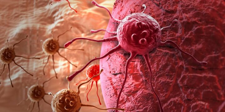 Онкологія в Україні: стан, шляхи розвитку та профілактики