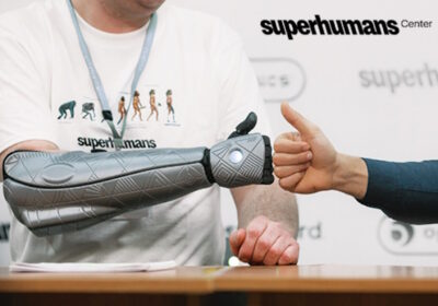 Superhumans Center – центр безкоштовного протезування місто Дніпро